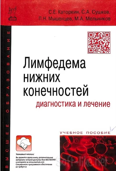 Лимфедема нижних конечностей, диагностика и лечение (2022)