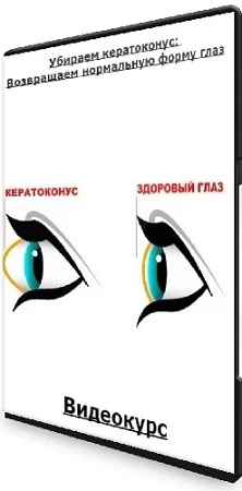 Людмила Лазарева. Убираем кератоконус: Возвращаем нормальную форму глаз (2023) Видеокурс